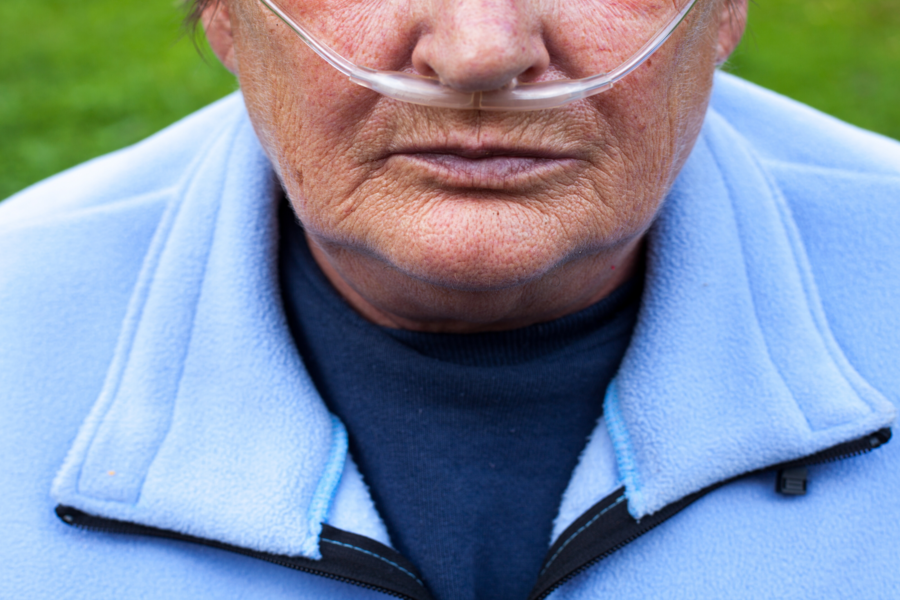 Hipertensión pulmonar