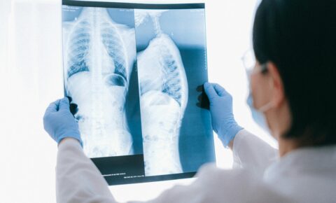 Día Mundial del Pulmón