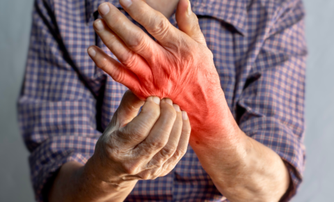 Sarcoidosis: ¿Qué es y cómo se trata?